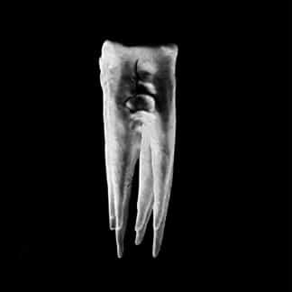 Chalk Teeth | Chalk Teeth
